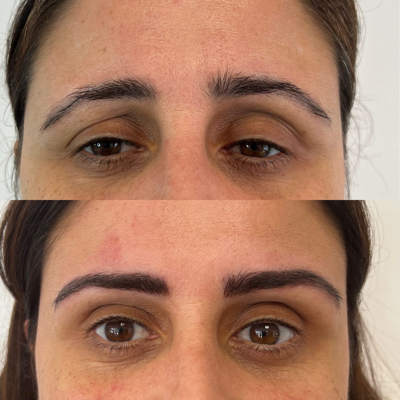 Medicina estética capilar en A Coruña tratamiento para fortalecer el pelo Clínica Dr Luna.